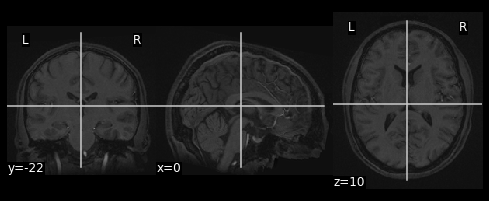 ../_images/5_Introduction_to_Neuroimaging_Data_41_1.png