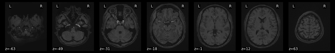 ../_images/5_Introduction_to_Neuroimaging_Data_43_1.png